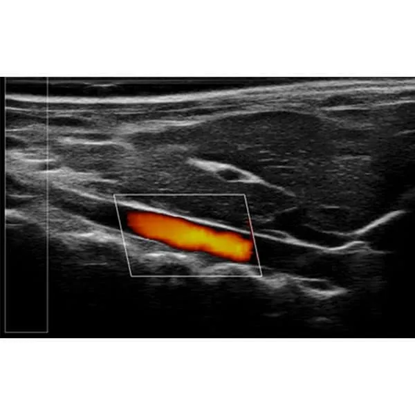 Высокочастотная система ультразвуковой визуализации для мелких домашних животных