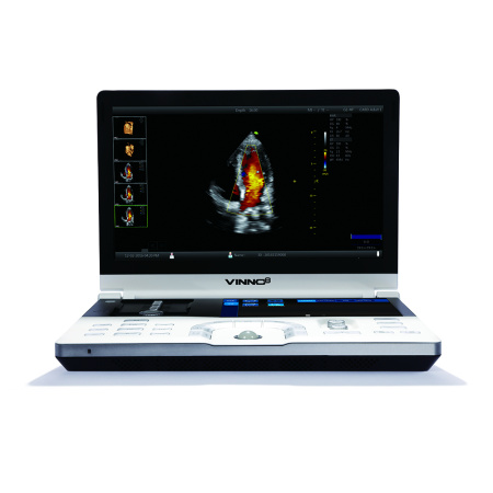 Портативный УЗИ-аппарат VINNO 8