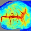 Лазерная спекл-контрастная система визуализации RFLSI-ZW Лазерная спекл-контрастная система визуализации RFLSI-ZW