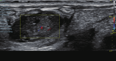 mouse_petal_heartbeat